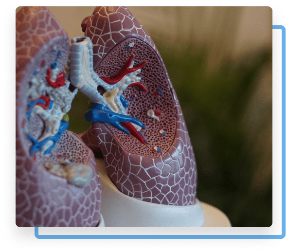 Airphysio about lungs
